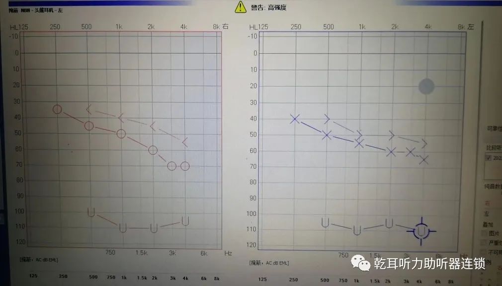 青岛助听器