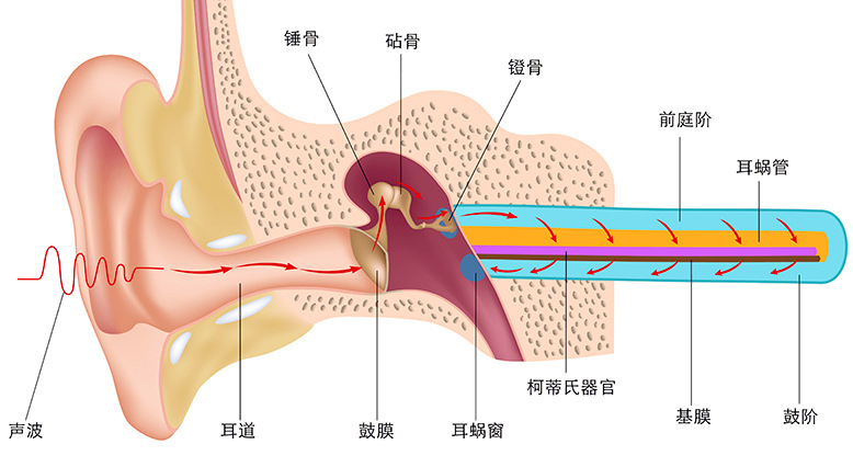 听力损失分类